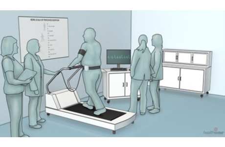 Exercise Electrocardiogram (Stress Test)