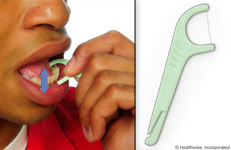 Person using a flossing tool to floss, moving floss up and down between two teeth.