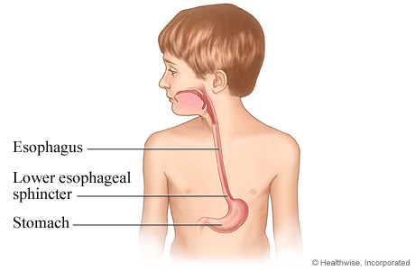 Picture of esophagus in child