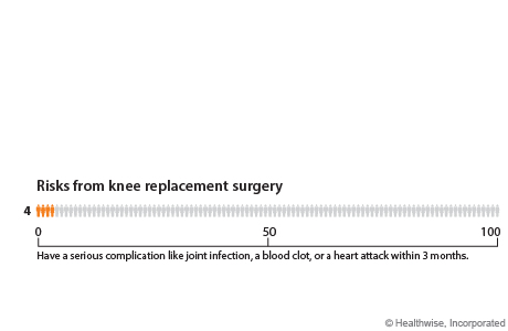 Out of 100 people who have knee replacement surgery, 4 will have a serious complication like joint infection, a blood clot, or a heart attack within 3 months.