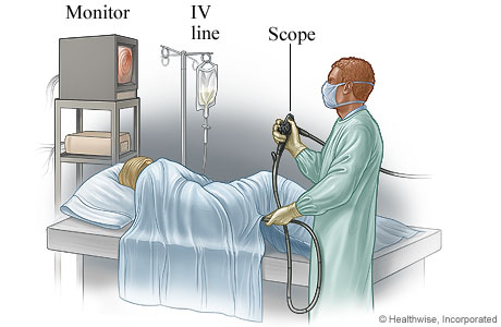 A person having a colonoscopy A person having a colonoscopy