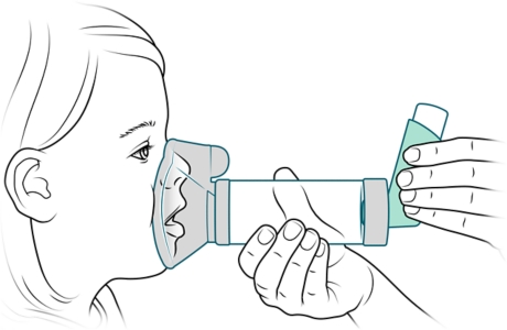 Mask spacer placed securely over child's mouth and nose.