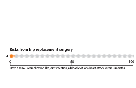 Out of 100 people who have hip replacement surgery, 4 will have a serious complication like joint infection, a blood clot, or a heart attack within 3 months.